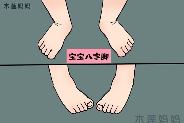 【你的育儿经】宝宝走路“八字脚”,都是因为家长们犯的这些错误,及时纠正