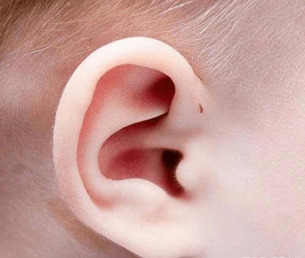 宝宝耳朵为什么有"小孔"?医生一般不说,家长心里要有数