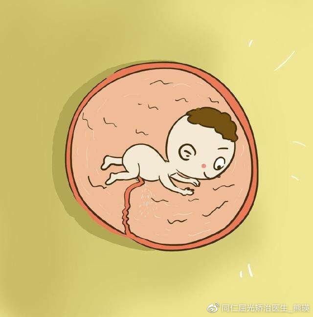 生活矜持点|孩子视力不好？可能是母亲孕期导致