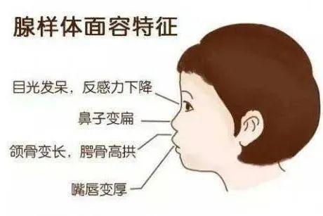 儿童|孩子睡觉打呼噜=睡得香？医生：小心变丑变笨