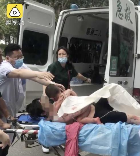 荆楚网|热水器突然爆炸！一家三口严重烧伤，当时正在给幼儿洗澡