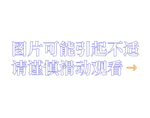 惊了！广东一男子体内揪出大量活虫，这个习惯你可能也在犯..