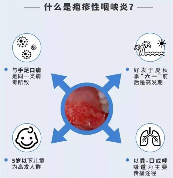 疱疹|长沙一家医院日均接诊6例！近期高发，孩子出现这些症状请当心