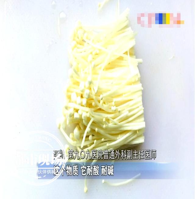 凉拌菜|女子肠子差点“堵死”，请自查