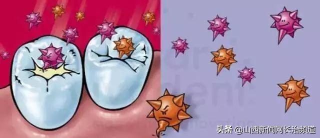 超级宝妈|长兴口腔六一儿童节福利，快带孩子来免费做窝沟封闭吧