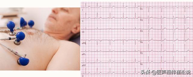 心电图|得了心脏病哪些检查最准确？这份“心脏检查指南”请收好！