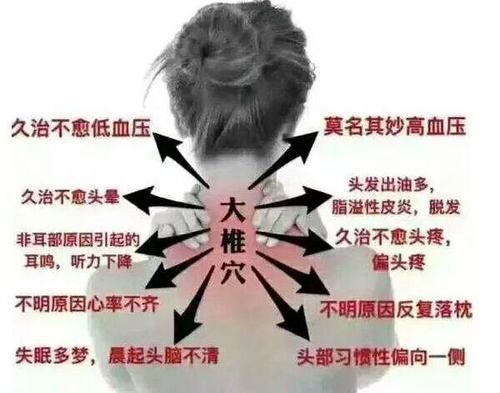 富贵包与高血压——病人终生吃药的另一种原因