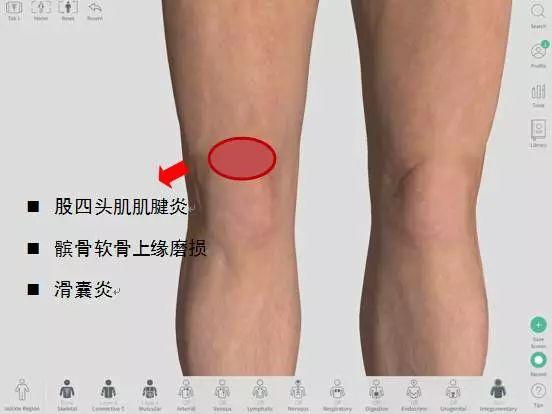 我的膝盖怎么了？——膝关节不同部位疼痛的原因