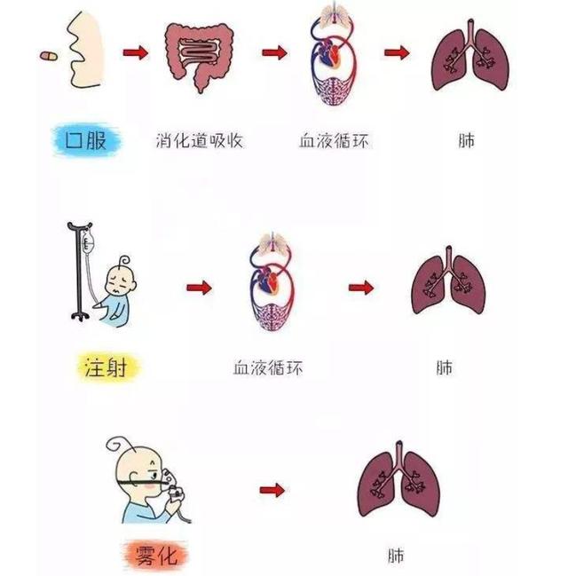 你的育儿经|孩子咳嗽就该去做雾化吗？家长了解这些知识明明白白做雾化