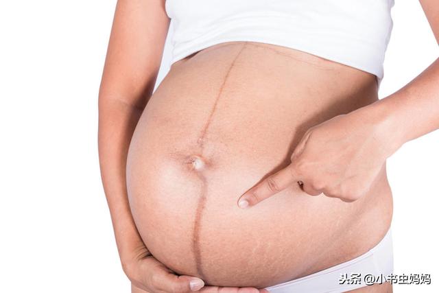 春风▲婆婆会看懂肚子上的妊娠线?妊娠纹的预防和注意方法,孕妇需了解