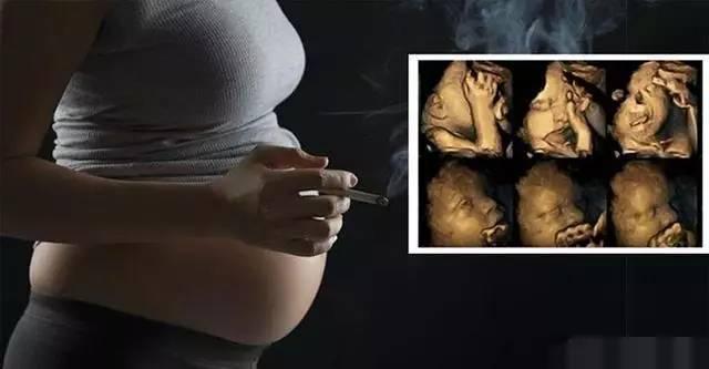 「超级宝妈」孕期妈咪一定要警惕二手烟的危害
