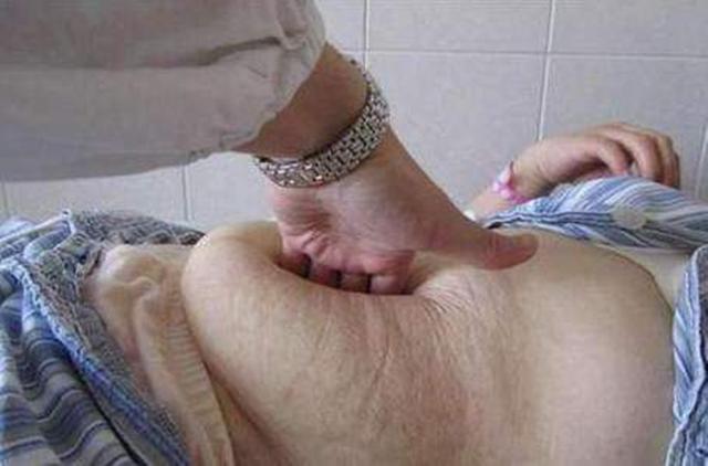 你的育儿经|选剖腹产不疼？这根10厘米的麻醉针仅仅是开始，疼到你怀疑人生