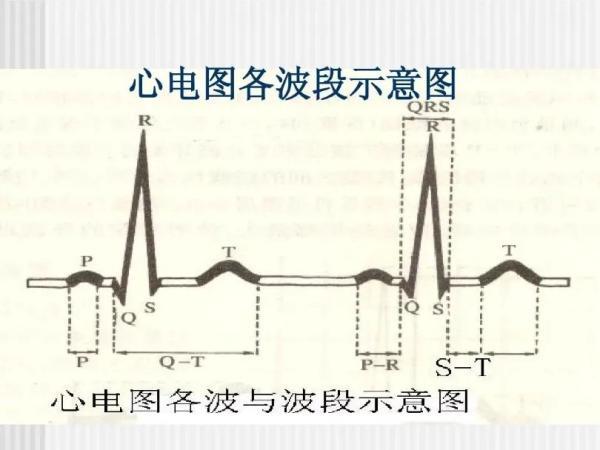 心电图|体检必查的心电图，如何看出自己潜在的心脏疾病？