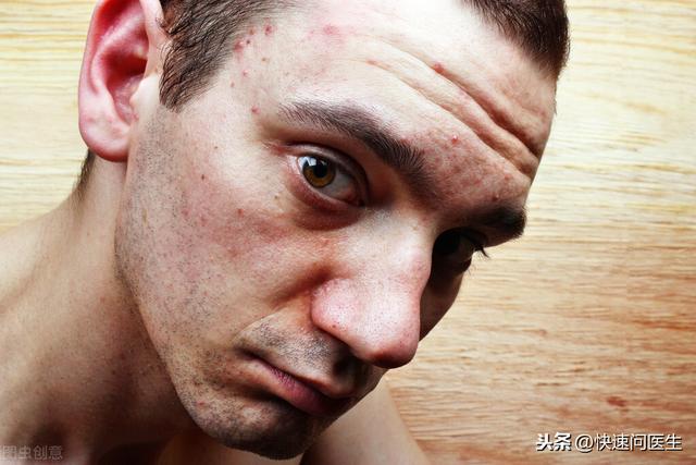 为何“肺结节”的人越来越多？做好这几点很重要，帮你摆脱结节