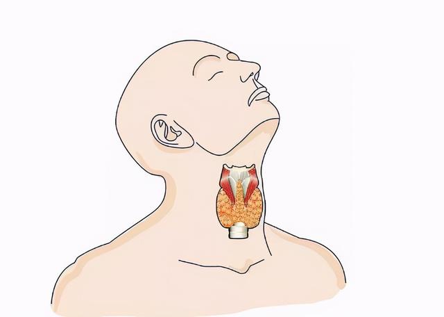 只要颈部长疙瘩（包块）就是甲状腺癌吗？