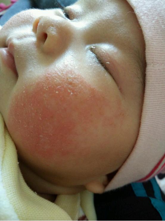 「你的育儿经」奶奶带娃3年，孩子从未湿疹，只用了这一招，皮肤好身体棒