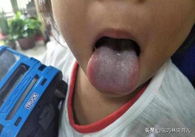 「超级宝妈」脾胃强则安五脏！家长给娃养脾胃，试试这2招让孩子不打针不吃药