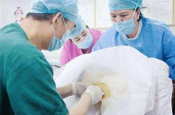 超级宝妈|丈夫陪产妻子闹笑话,想要陪产这几件事很重要,早了解早准备