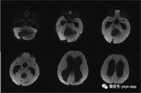 经典病例分享