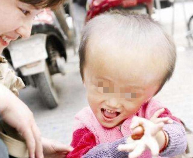 【你的育儿经】当年喝了三鹿奶粉的孩子,12年过去了, 如今怎样了? 心疼这些孩子