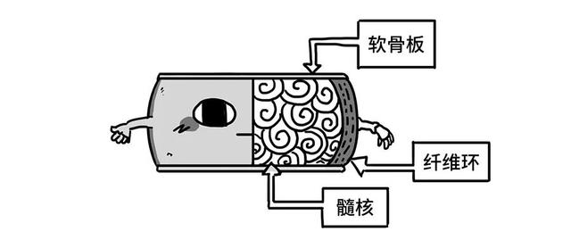 腰椎间盘突出，其实就像婆媳矛盾