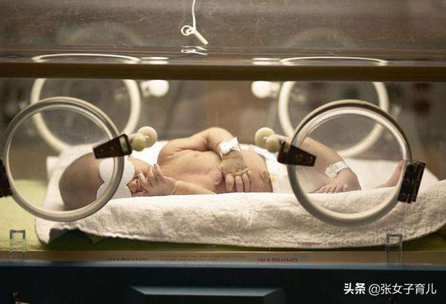 『你的育儿经』想要宝宝出生后，远离黄疸问题，孕期需要坚持这3个好习惯