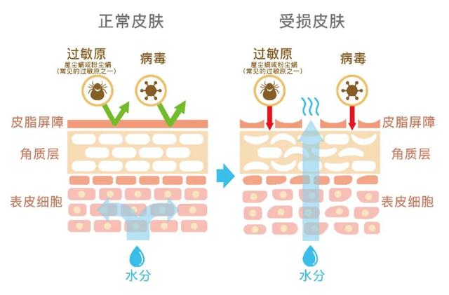 男默女泪，有多少人一入冬就脚跟干裂？