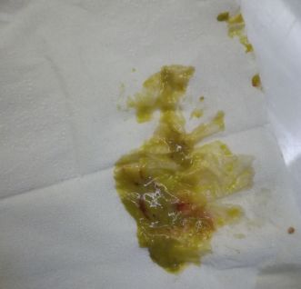 「暖先生格调」宝宝拉绿便就是奶粉的“锅”？饥饿、辅食......这些都可能，附图干货拿去！