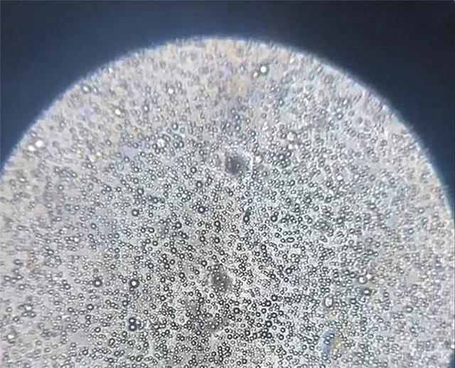 你的育儿经：将母乳放大1000倍是什么样？显微镜下的图片，当妈的都要看一看