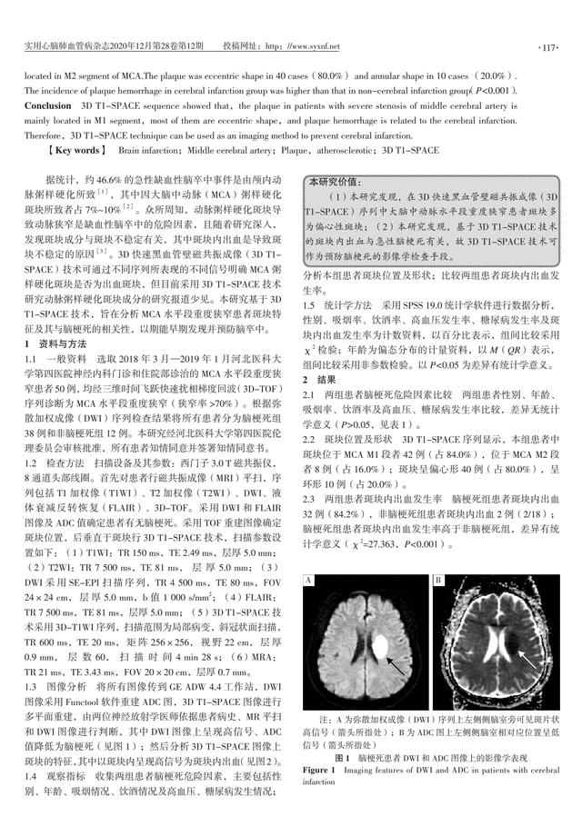 大脑中动脉水平段重度狭窄患者斑块特征及其与脑梗死的相关性分析