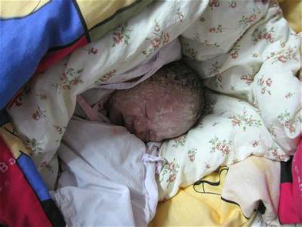 你的育儿经|新生儿裹着“奶油”出生，爸爸看后焦急大哭，医生却说恭喜