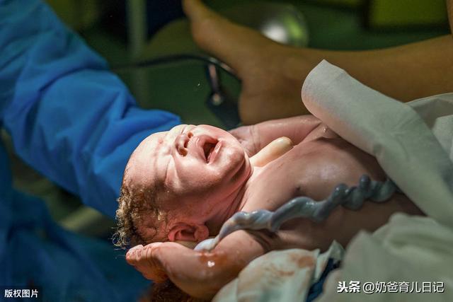 [你的育儿经]脐带绕颈是什么？影响顺产么？