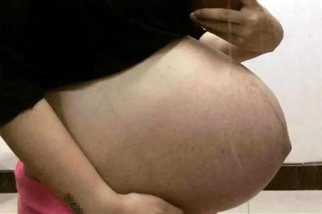 超级宝妈:“悬浮肚”爆红网络,孕妈痛苦有谁知!网友:双胞胎?哪吒转世?