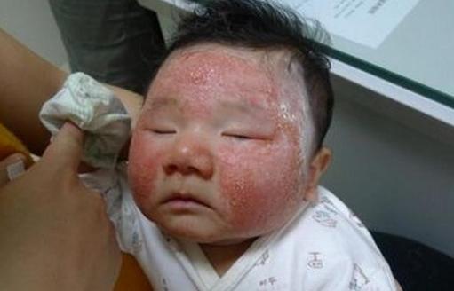 超级宝妈■孕妇孕晚期吃鹅蛋并非有“去胎毒”功效，而是这些，早了解早受益