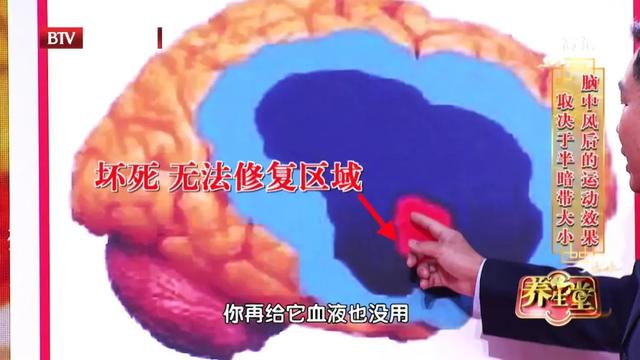 恢复|中风后能恢复到中风前的状态吗？一套平衡操、三种健脑食物，或许可以帮到你