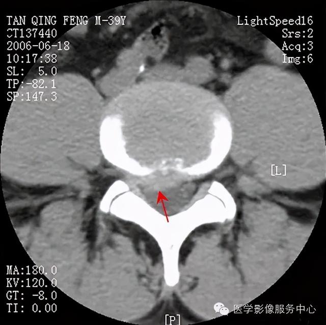 77种骨肌影像病例，助你诊断无忧