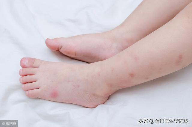 「健康直通车」夏季要注意的５种高发疾病，预防方法请收好，谨防中招