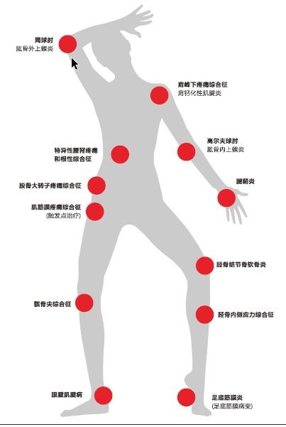 冲击波|你还在为各种疼痛烦恼吗？金山这家医院有个治痛“神器”