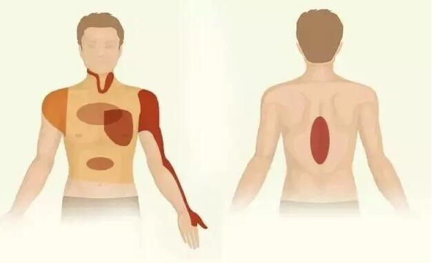 左臂|这个地方疼真不是骨科病，心跳随时可能停！45岁后互相提醒