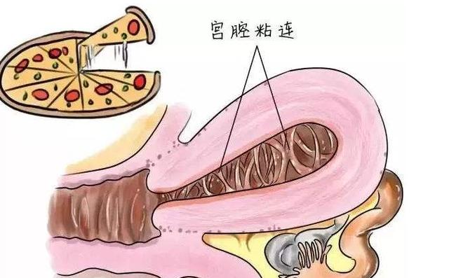 「你的育儿经」胚胎停止发育都是孕酮不足惹的祸？
