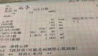 血管|牙疼、头疼、犯困，竟是心绞痛带的？