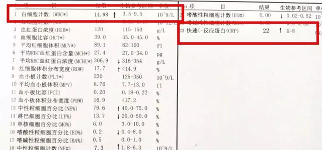 咽喉痛|喉咙痛会加重肾病？肾友必备的应对技巧