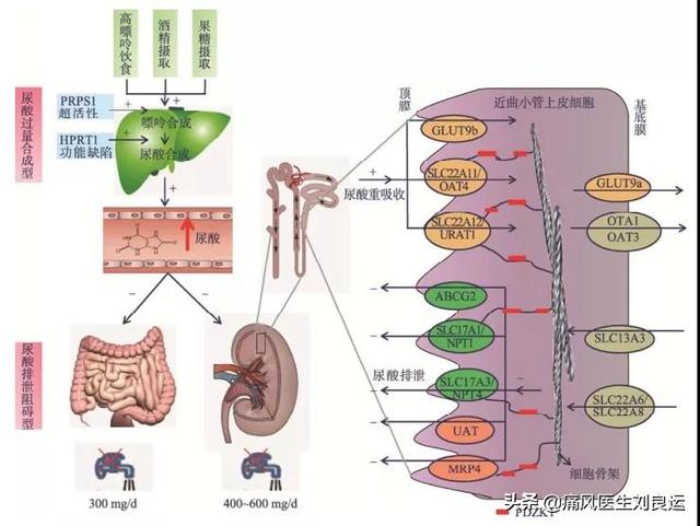 痛风发作后担心长痛风石？做好三件事预防尿酸盐结晶沉积在关节