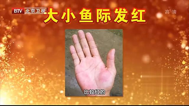 肝脏|手上一个变化，是肝在求救！4种天然养肝王，常吃补肝防病