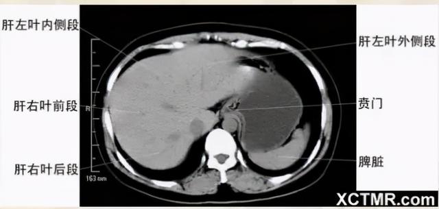 影像解剖：胸、腹部、盆腔CT解剖
