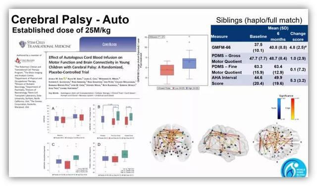 杜克大学 | 干细胞治疗脑瘫等疾病进展喜人
