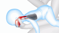 孩子吃东西被异物卡喉，奶奶急的跺脚，妈妈的做法挽回孩子性命