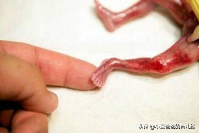 超级宝妈|14年前那个史上最小婴儿，把蛋壳当“摇篮”，现在过得怎么样呢