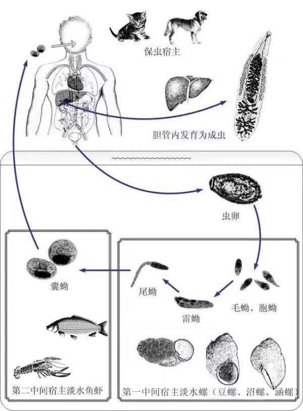 肝吸虫|女子突发高烧紧急住院！原因竟是春节家庭聚餐时……