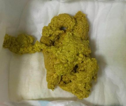 「暖先生格调」宝宝拉绿便就是奶粉的“锅”？饥饿、辅食......这些都可能，附图干货拿去！